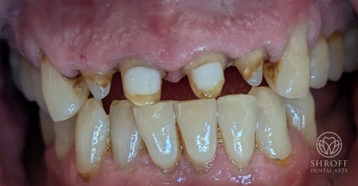 Smile before dental treatment 