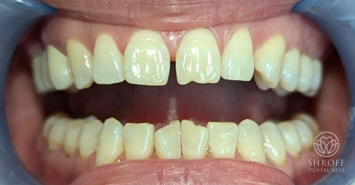 Smile before dental treatment 