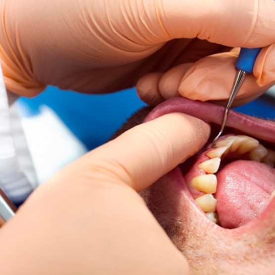 Dentist treating patient with gum disease