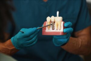 Dentist holding up dental implant model.